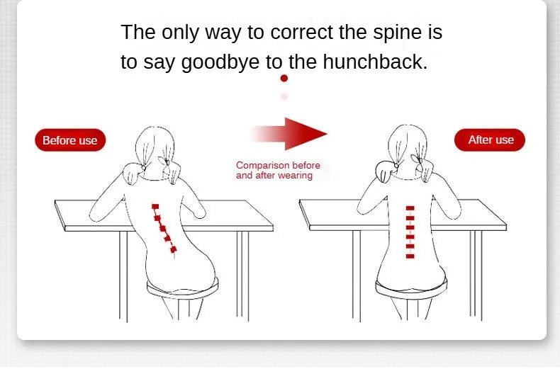 Correcteur De Posture De scoliose réglable, Corset, attelle dorsale, soutien lombaire, correcteur droit De ceinture De dos - crazyfinds.frMa boutiqueGrayLCHINACorrecteur De Posture De scoliose réglable, Corset, attelle dorsale, soutien lombaire, correcteur droit De ceinture De dos